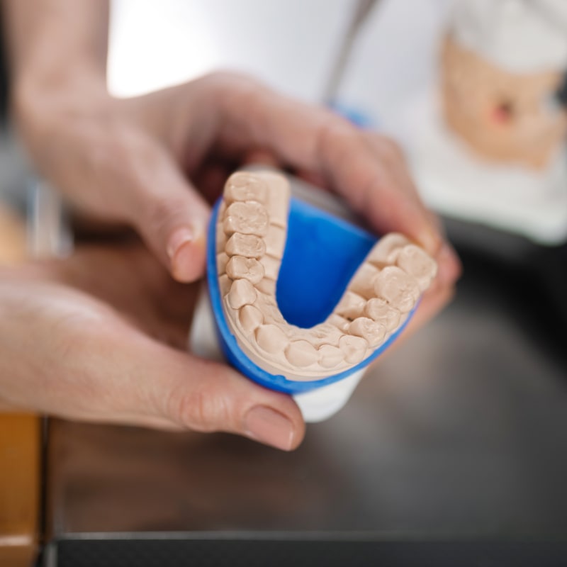 Mouth Guards, London Dentist